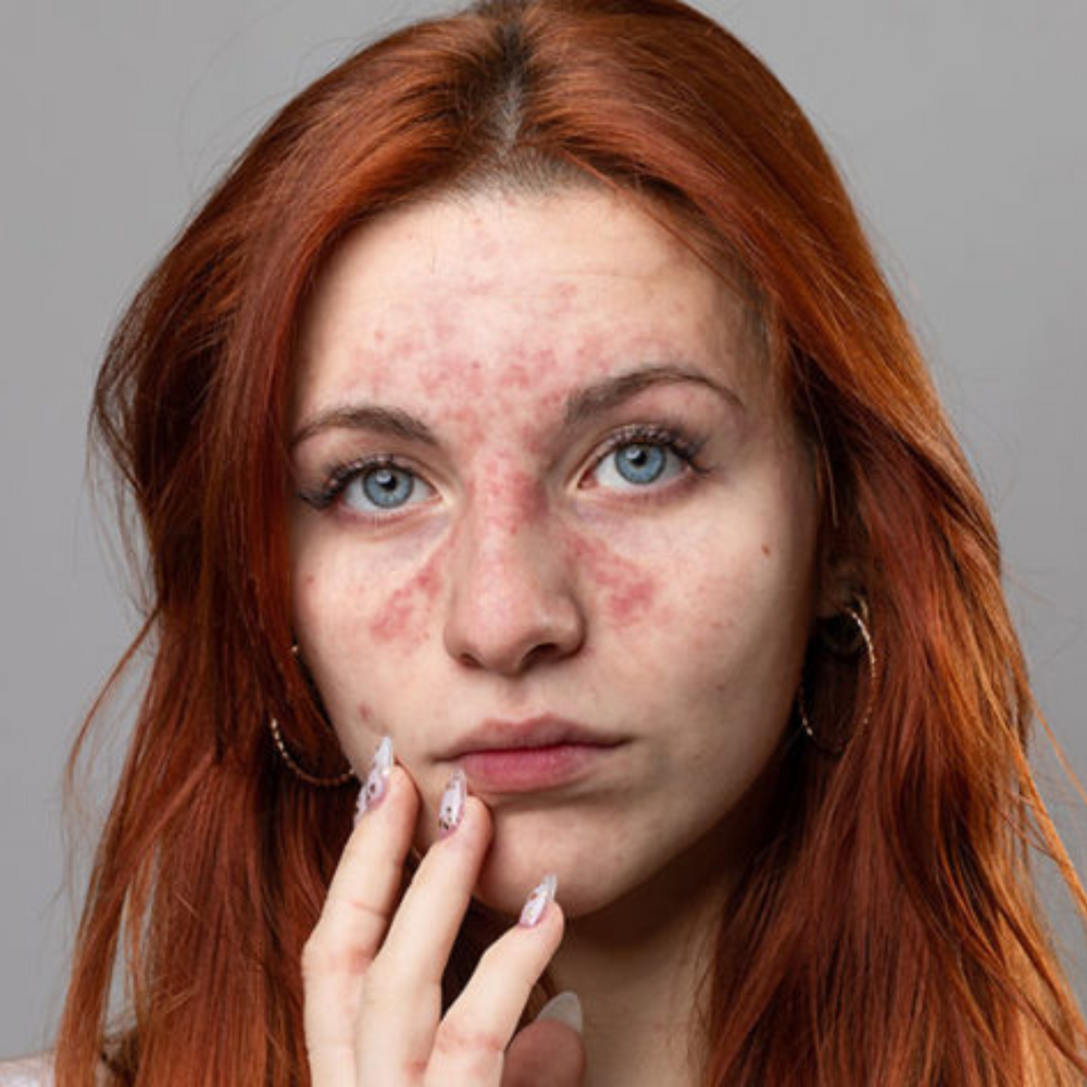 TryStrawberry Before and after comparison