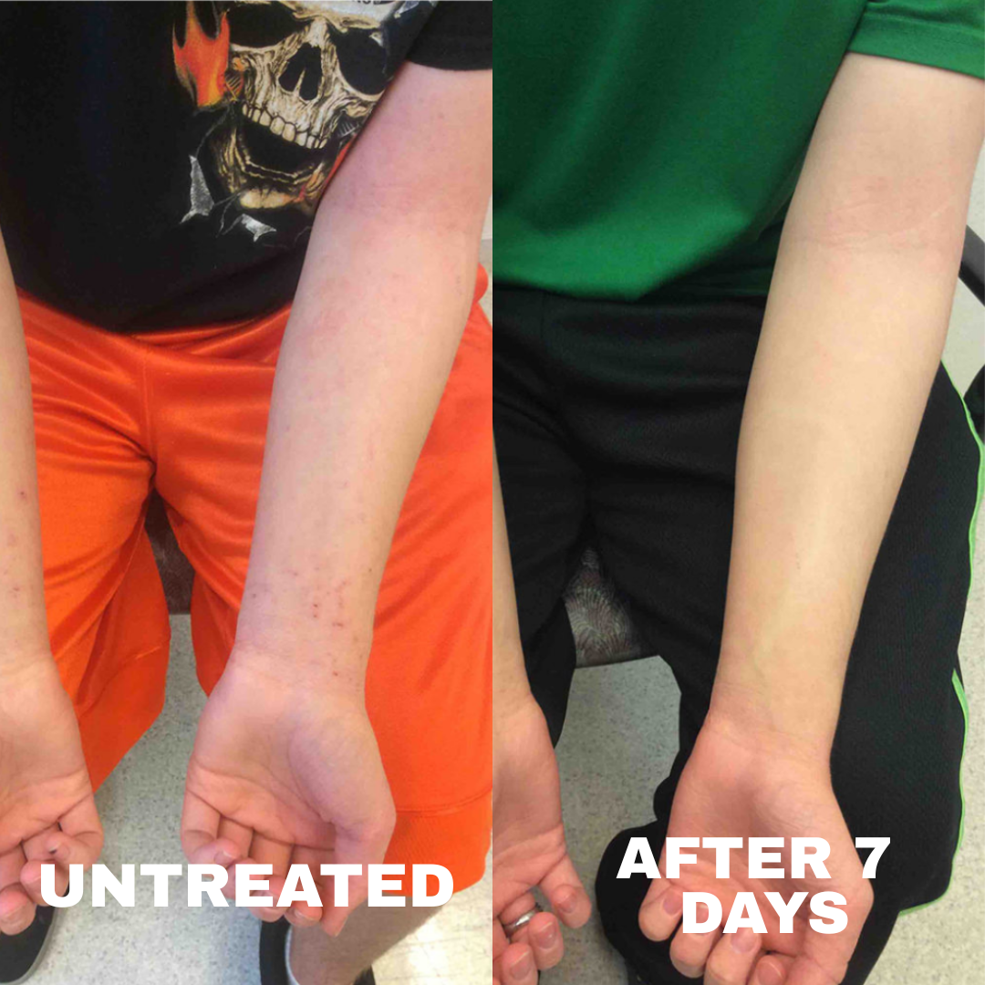 TryStrawberry Before and after comparison