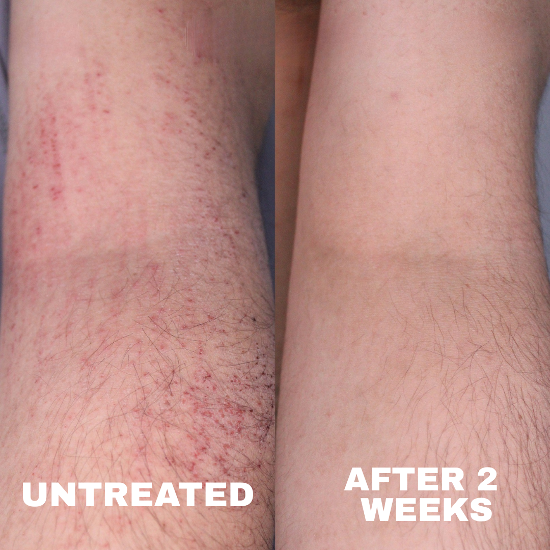 TryStrawberry Product review, before after
